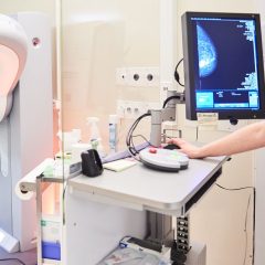 Screening mammografico, siglata intesa Europa Donna-Regione siciliana
