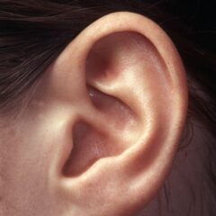 World Hearing Day, nel mondo 1 persona su 5 soffre di un calo dell’udito