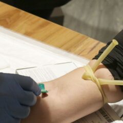 Test e vaccinazioni per prevenire malattie sessualmente trasmissibili